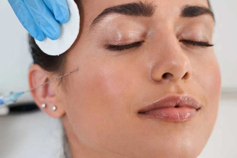 Are Dermal Fillers the Same as Lip Fillers? A Comprehensive Guide