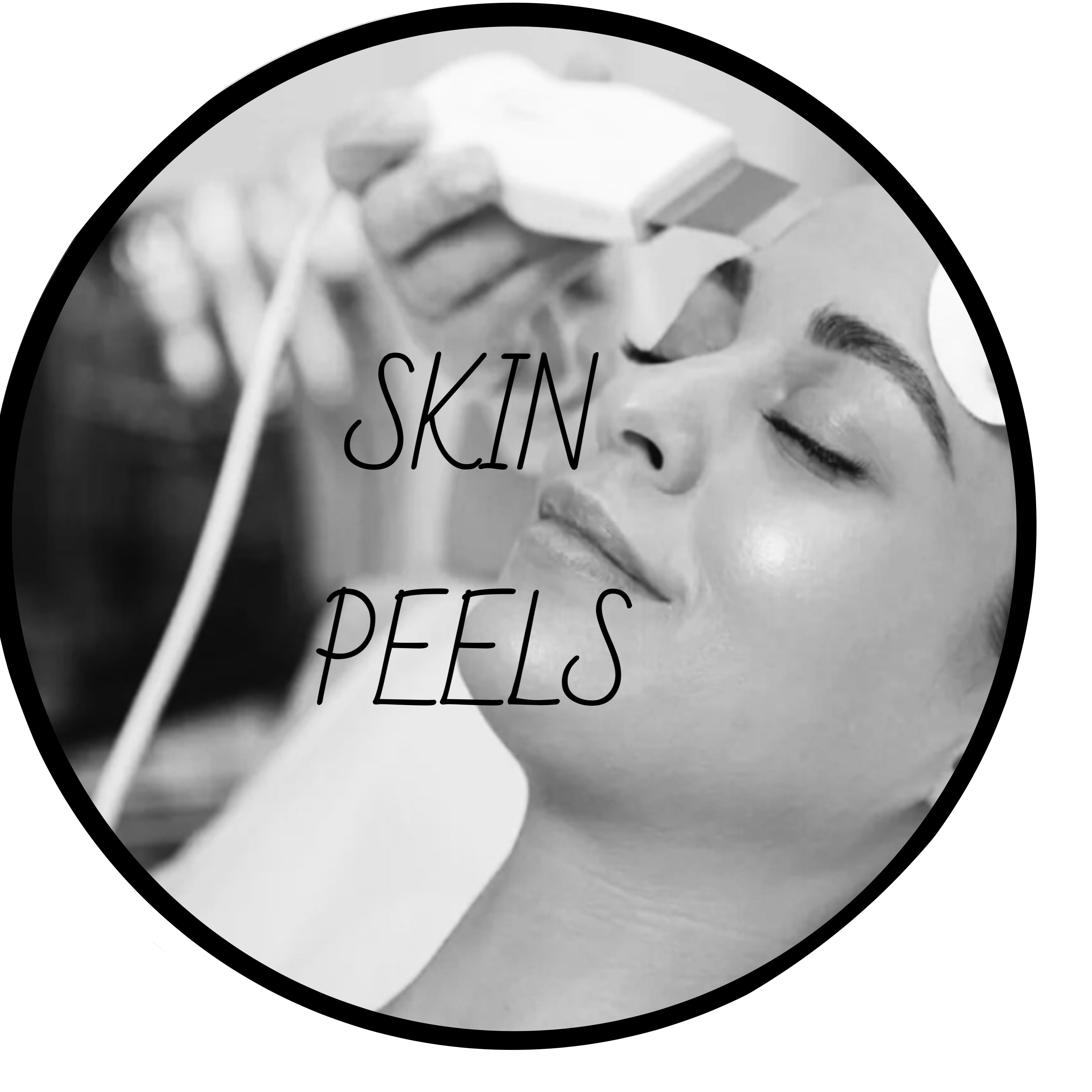 Skin Peels