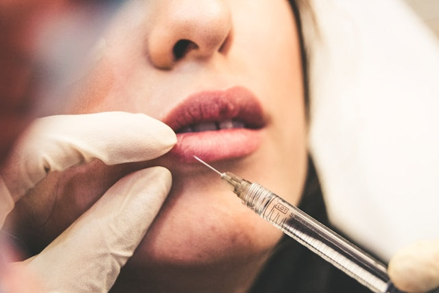 The Ultimate Guide to Dermal Fillers: What You Need to Know